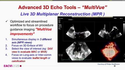 Presentation thumbnail