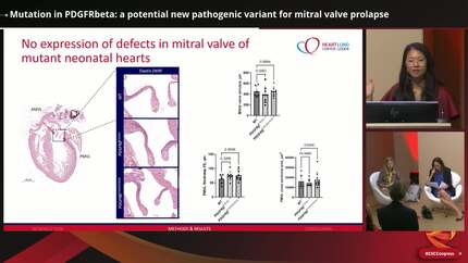 Mutation in PDGFRbeta: a potential new pathogenic variant for mitral valve prolapse