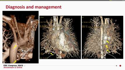 Presentation thumbnail