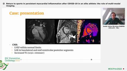 Return to sports in persistent myocardial inflammation after COVID-19 in an elite athlete: the role of multi-modal imaging.