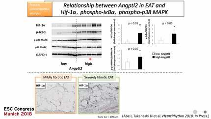 Profile of pro-inflammatory cytokines in epicardial adipose tissue in patients with atrial fibrillation: association with atrial myocardial fibrosis