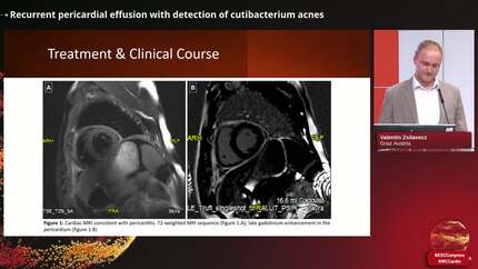 Presentation thumbnail