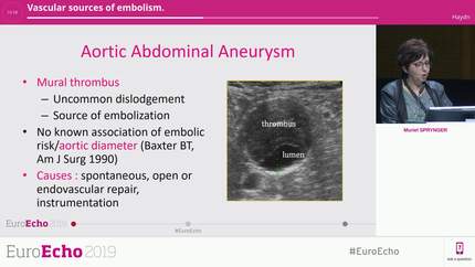 Vascular sources of embolism.