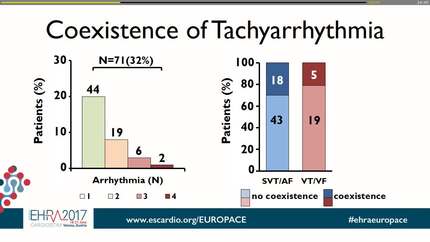 Coexistence of atrial and ventricular tachyarrhythmias in patients with tetralogy of fallot