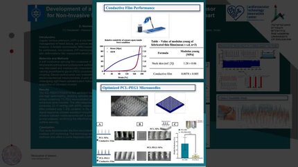 Development of a flexible conductive microneedle-based sensor for non-invasive monitoring of jugular venous pressure in heart failure patients