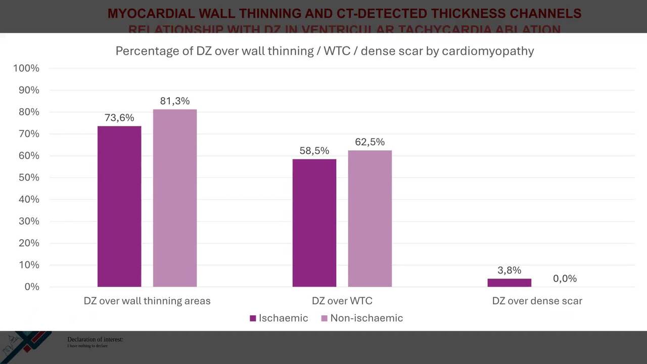 Myocardial wall thinning and CT-detected thickness channels: relationship with DZ in ventricular tachycardia ablation