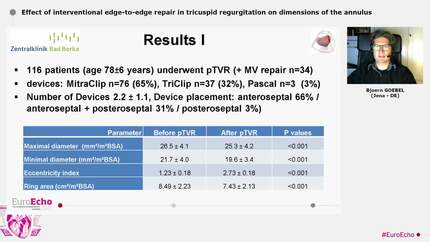 Effect of interventional edge-to-edge repair in tricuspid regurgitation on dimensions of the annulus