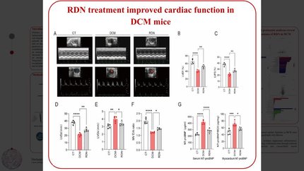 Integrated multi-omics analysis reveals the molecular mechanisms of renal denervation in alleviating diabetic cardiomyopathy