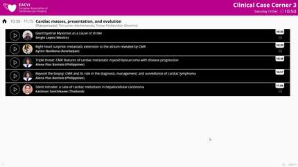 Cardiac masses, presentation, and evolution