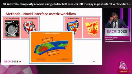 3D substrate complexity analysis using cardiac MRI predicts ICD therapy in post-infarct ventricular tachycardia