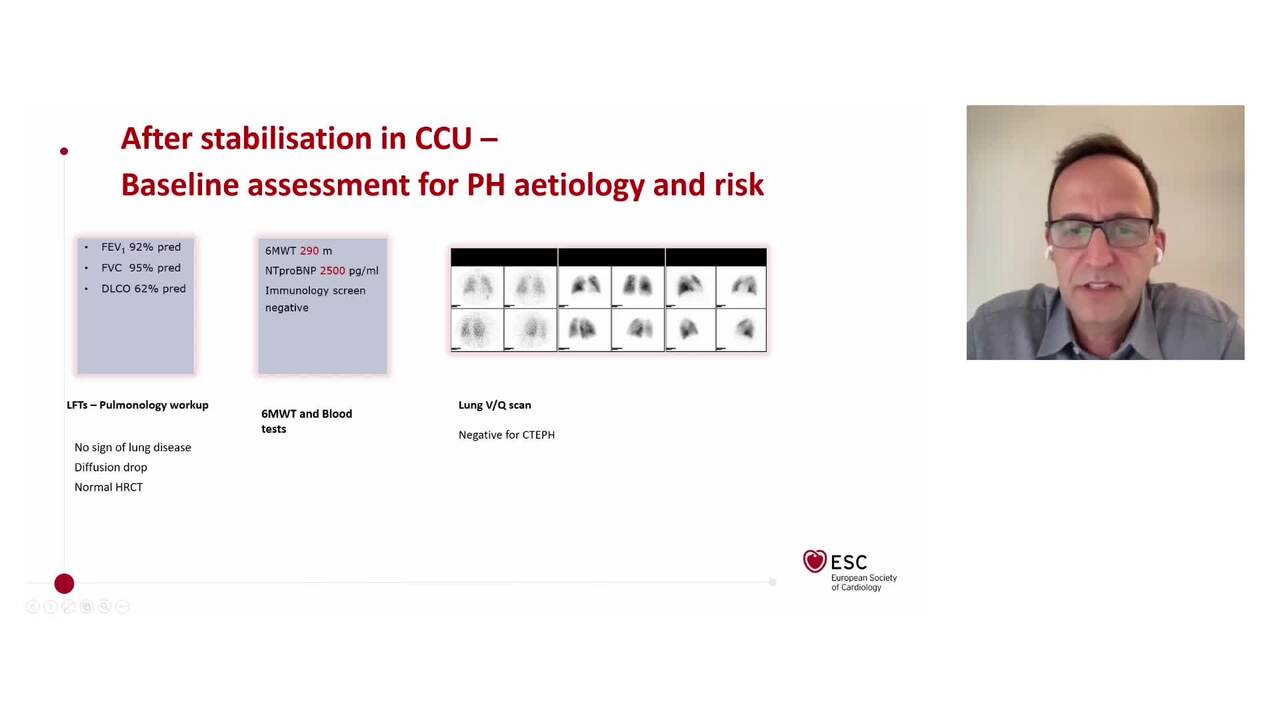 Right ventricular dysfunction in practice: a multidisciplinary, case-based approach
