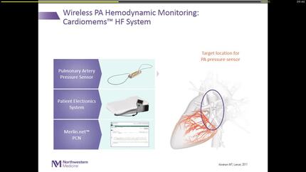 Implantable monitoring-only technologies: CardioMEMS and LAPTOP.