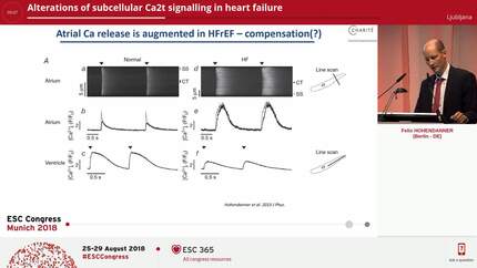 Alterations of subcellular Ca2t signalling in heart failure