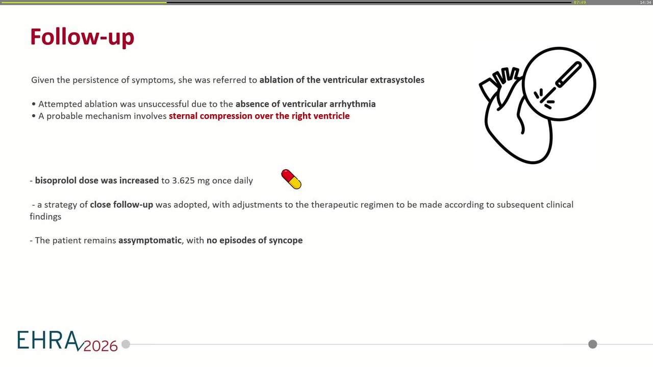 The heart beneath the sternum: a case of ventricular arrhythmia in pectus excavatum