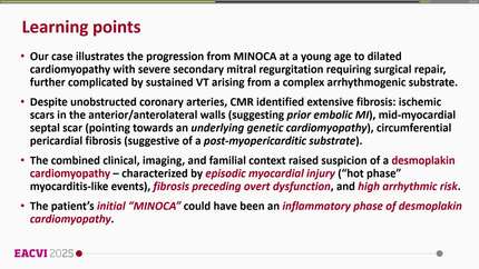 From MINOCA to complex ventricular tachycardia: unmasking a suspected desmoplakin cardiomyopathy through multimodality imaging