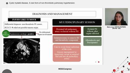 Cystic hydatid disease. A rare form of non-thrombotic pulmonary hypertension.