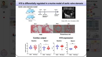 Long noncoding RNA H19 is elevated in aortic valve stenosis and governs angiogenic response and valvular endothelial cell phenotypes through endothelial to mesenchymal transition