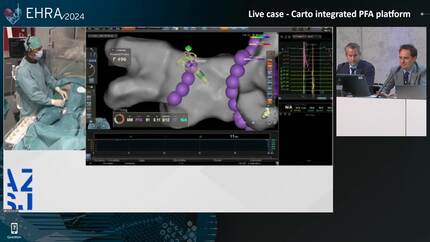 CARTO integrated PFA platform - Live case