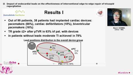 Presentation thumbnail