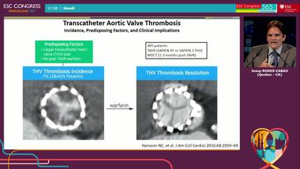 Journal of the American College of Cardiology’s Year in valvular heart disease: assessment & intervention.