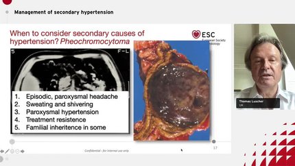 Presentation thumbnail