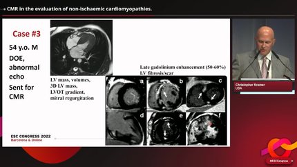 Presentation thumbnail