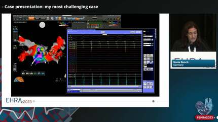 Live-in-the-Box: atrial tachycardia after AF ablation