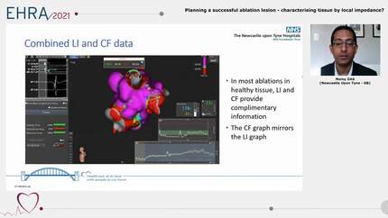 Planning a successful ablation lesion - characterising tissue by local impedance?