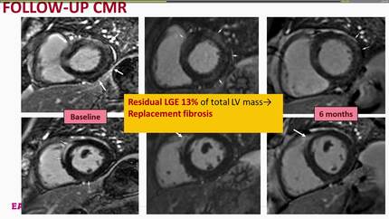 Presentation thumbnail