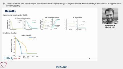 Characterization and modelling of the abnormal electrophysiological response under beta-adrenergic stimulation in hypertrophic cardiomyopathy