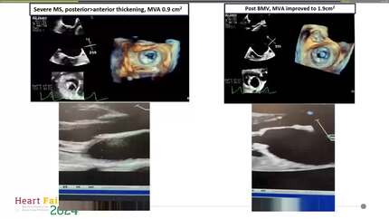 Presentation thumbnail