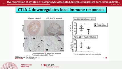 Overexpression of Cytotoxic T-Lymphocyte Associated Antigen-4 suppresses aortic immunoinflammatory responses and prevents angiotensin II-induced abdominal aortic aneurysm formation in mice