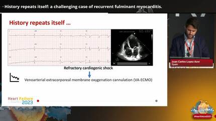 History repeats itself: a challenging case of recurrent fulminant myocarditis.
