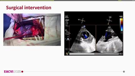 Presentation thumbnail