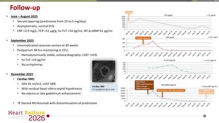 Complicated acute myocarditis during pregnancy  and ulcerative colitis flare: a case report