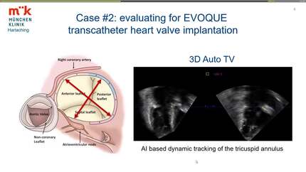 Presentation thumbnail