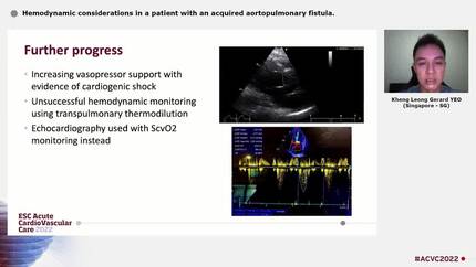 Hemodynamic considerations in a patient with an acquired aortopulmonary fistula.