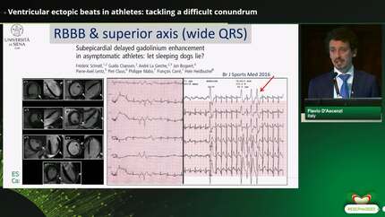 Essentials - current concepts and conundrums in athletes - from diagnosis to management
