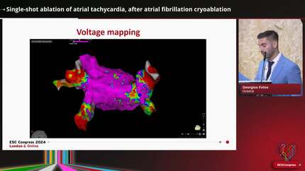 Single-shot ablation of atrial tachycardia, after atrial fibrillation cryoablation