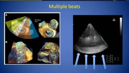 Presentation thumbnail