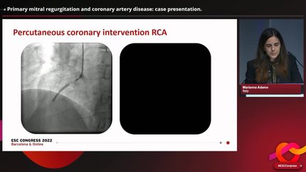 Presentation thumbnail