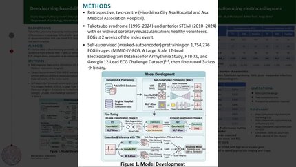 Deep learning-based differentiation of Takotsubo syndrome and anterior acute myocardial infarction using electrocardiograms
