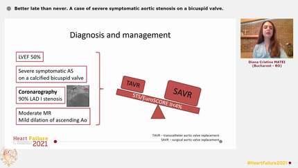 Better late than never. A case of severe symptomatic aortic stenosis on a bicuspid valve.