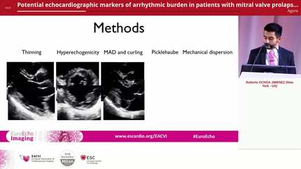 Potential echocardiographic markers of arrhythmic burden in patients with mitral valve prolapse and mild regurgitation 