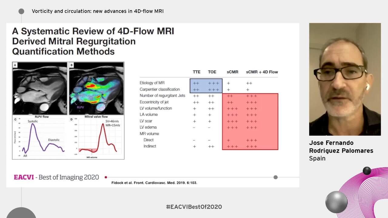 Vorticity and circulation: new advances in 4D-flow MRI