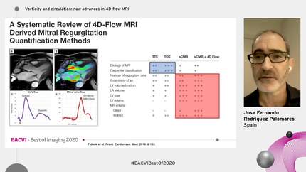 Vorticity and circulation: new advances in 4D-flow MRI