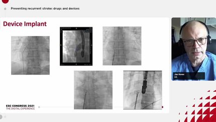 Presentation thumbnail