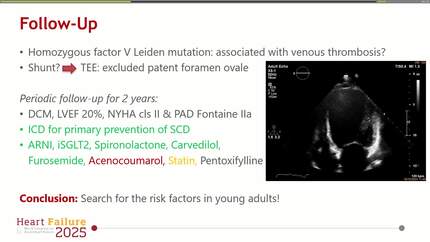 From acute myocardial infarction related-cardiogenic shock to chronic heart failure in a young adult: cause, management and long-term follow-up 