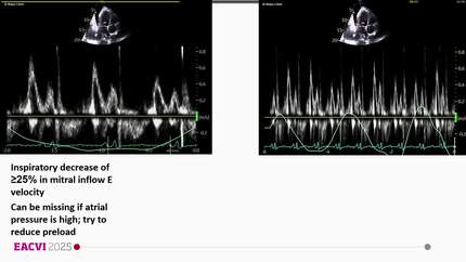 Presentation thumbnail