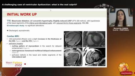 A challenging case of ventricular dysfunction: what is the real culprit?